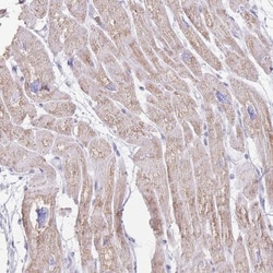 LCLAT1 Antibody, Novus Biologicals:Antibodies:Primary Antibodies
